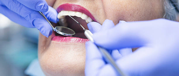 Best Emergency Dental Surgery in Warrenton, MO